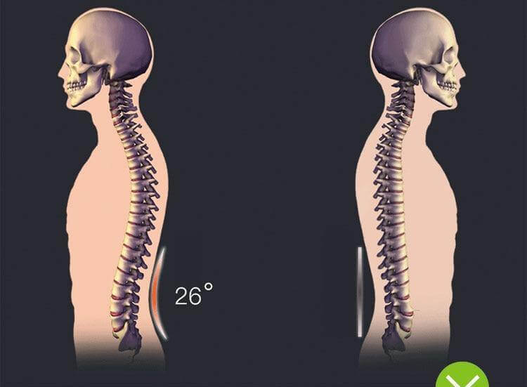 Magic Stretcher Chiropractic Back Massager - MaviGadget
